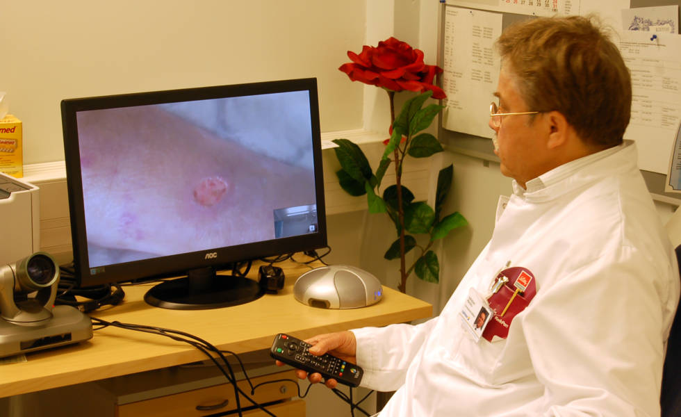 Mieslääkäri katsoo tietokoneen kuvaruudulta etäpotilaan haavaa.